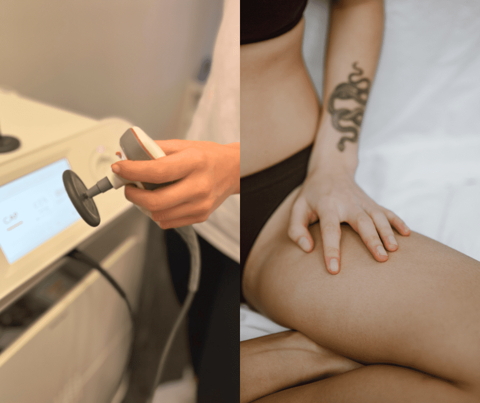 Zahvaljujući ovom tretmanu noge su mi se stanjile za čak 15 cm!