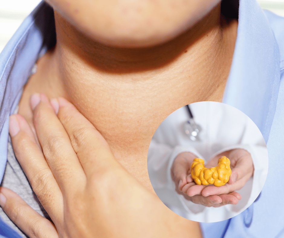 Muči vas zdravlje štitnjače? Evo kako si pomoći na prirodan način