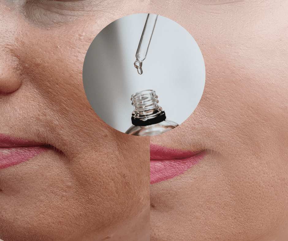 Peptidi su jedan od najboljih anti-age sastojaka: Pronašli smo ih u ovim proizvodima