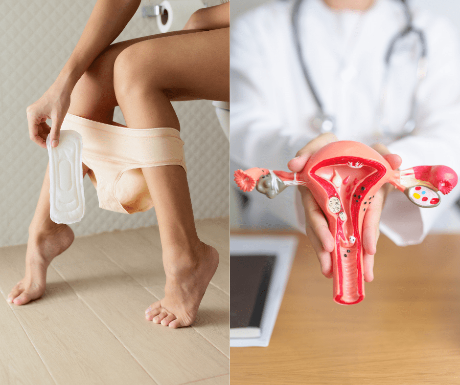 Kako na prirodan način potaknuti dolazak menstruacije? Pitali smo liječnicu