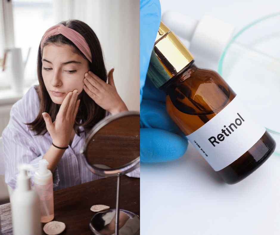 Tinejdžeri i retinol - trebaju li ga upotrebljavati i može li biti štetan?