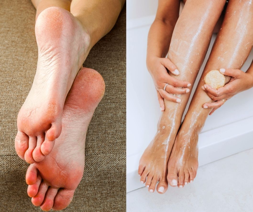 Zbog ove kupke za stopala sa sastojkom koji svi imate kod kuće zaboravila sam na grube rašpice