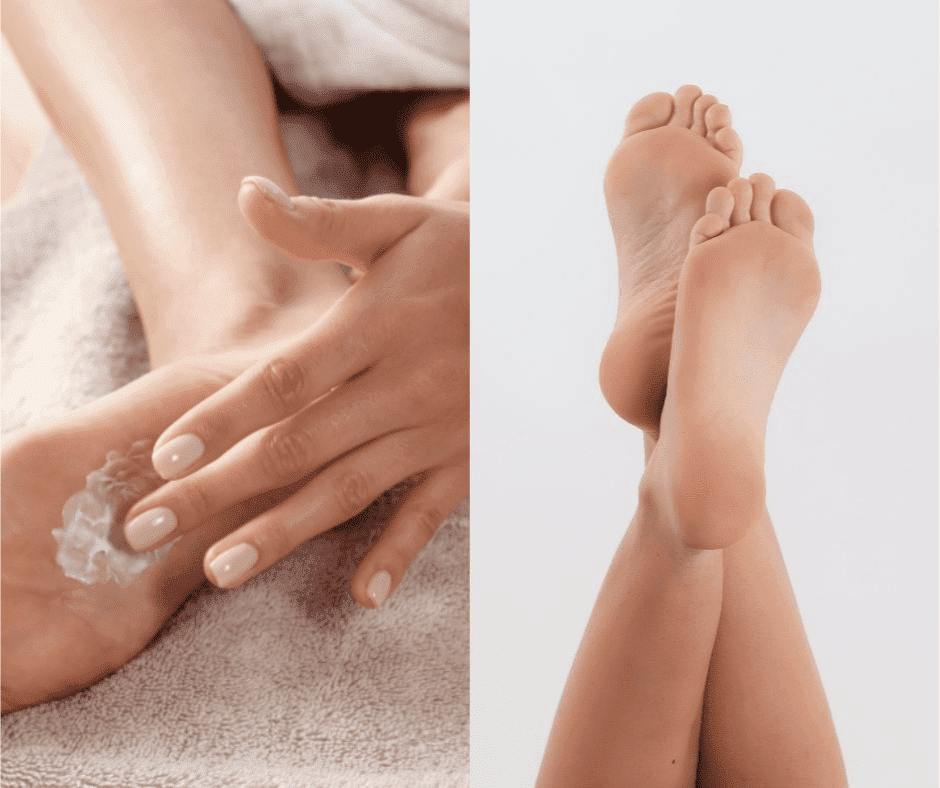 Zašto pete ljeti više pucaju i koji vam proizvodi mogu pomoći?