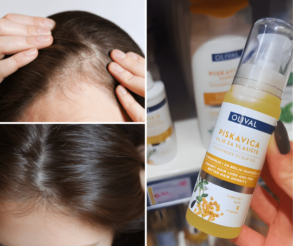 Olival je sada izbacio i Piskavica ulje za vlasište: losion i šampon dobili su nadopunu
