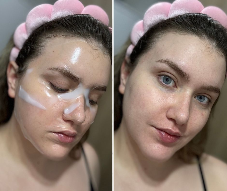 Napokon sam isprobala masku za lice o kojoj priča cijeli internet – ovako je reagirala moja suha koža