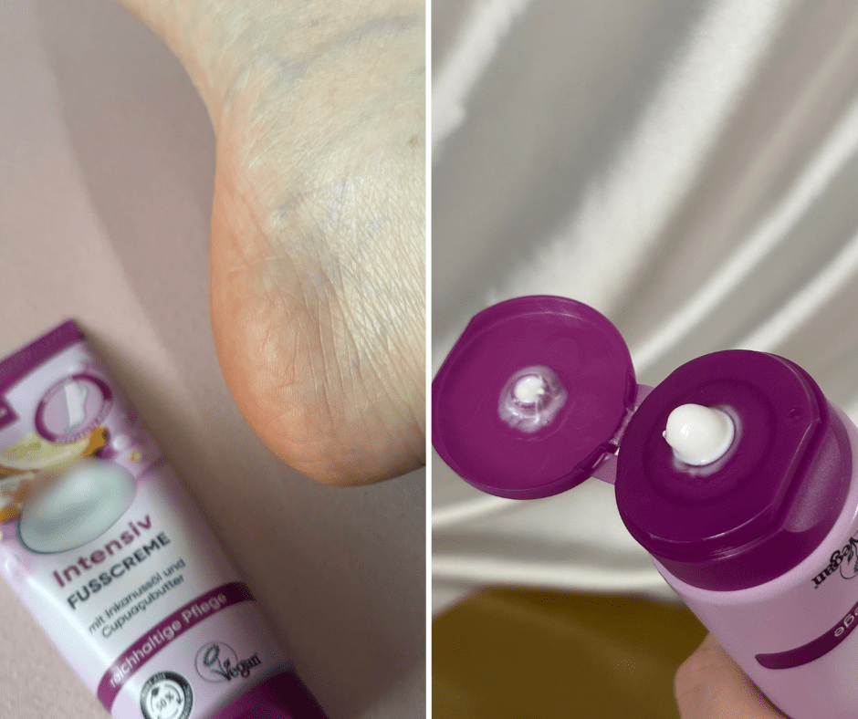 Ova krema košta manje od 2 eura – pruža odličnu njegu za kožu stopala i osjećaj ugode