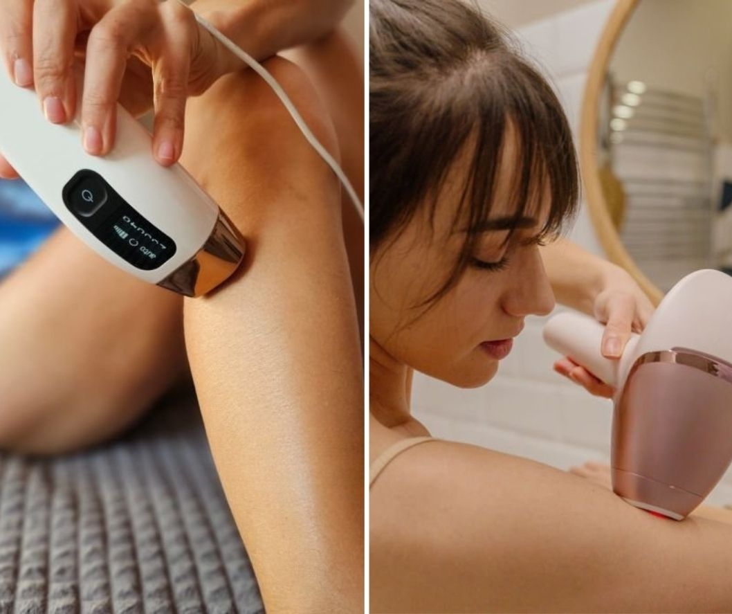 Sada je pravo vrijeme za krenuti s IPL tretmanom: izdvajamo 3 najprodavanija modela