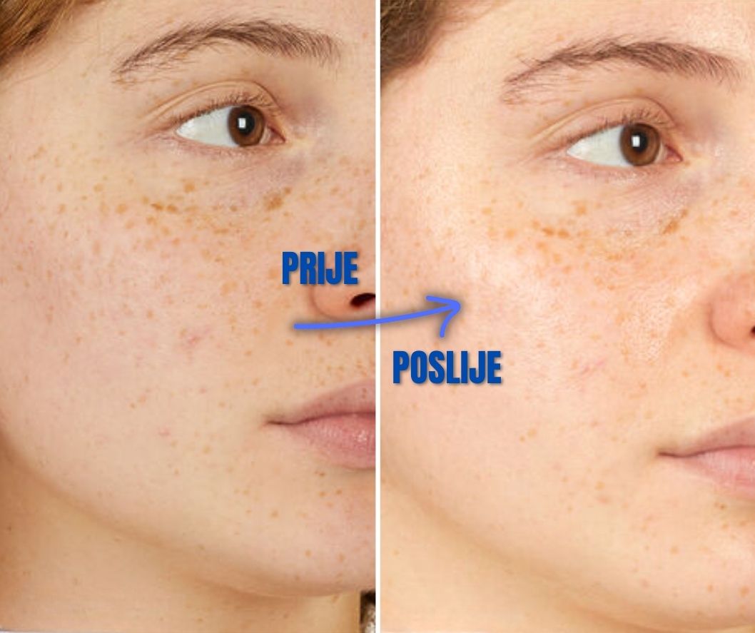 Ovaj je serum spas od hladnoće i idealan za zimu: umiruje kožu, smanjuje crvenilo i vraća sjaj