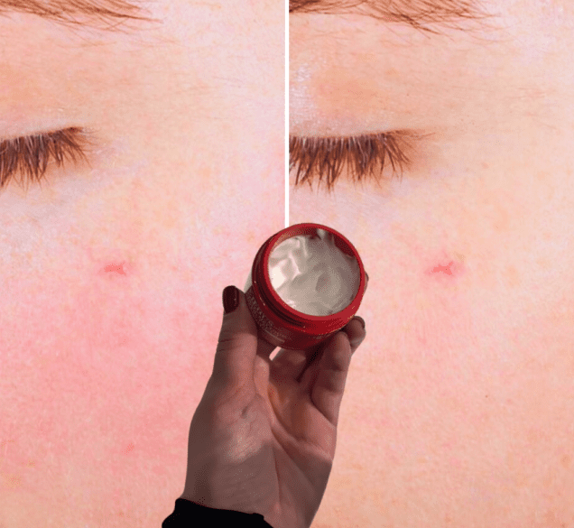 Vidljivo manje crvenila i potpuna hidratacija čak i za najosjetljivije lice – ova će vas krema oduševiti