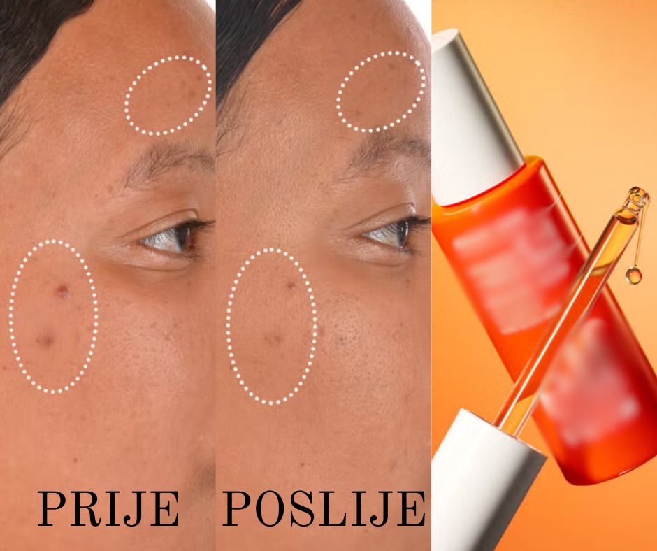 Novi serum za svjetliju i glađu kožu pomaže ujednačiti ten: svježa, odmorna i njegovana koža