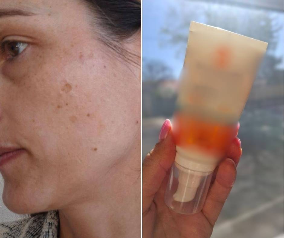 Krema sa zaštitnim faktorom koju ne preskačem – osobito zbog hiperpigmentacijskih mrlja