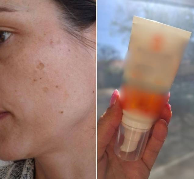 Krema sa zaštitnim faktorom koju ne preskačem – osobito zbog hiperpigmentacijskih mrlja