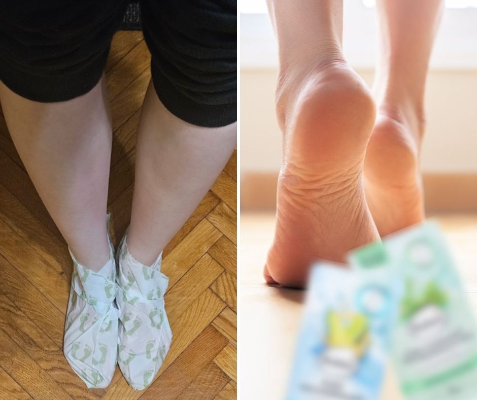 Suhe i ispucale pete: ovaj mi proizvod od 3 eura svake godine pripremi stopala za otvorenu obuću