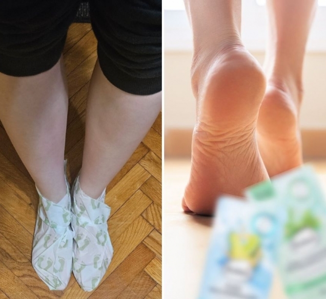 Suhe i ispucale pete: ovaj mi proizvod od 3 eura svake godine pripremi stopala za otvorenu obuću