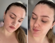 Isprobala sam hidrogel masku popularnog K-beauty brenda: vrijedi li ju isprobati i gdje je najpovoljnija?