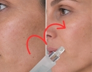 Napokon sam pronašla serum koji mi ne ostavlja ljepljiv osjećaj na licu: koža je mekana i hidratizirana