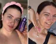 Viralni korejski beauty sastojak stigao je u novi serum: 97 % žena bi ga preporučilo za zaglađenu kožu