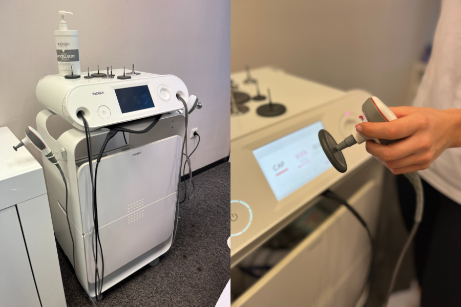 INDIBA EDNA uređaj i prva elektroda